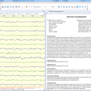 Электроэнцефалограф "Нейрон-Спектр-62"