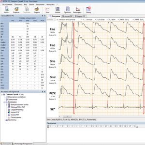 6-канальная зональная реопульмонография (РПГ)