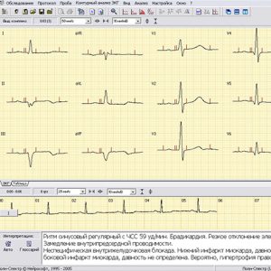 Поли-Спектр-ВР