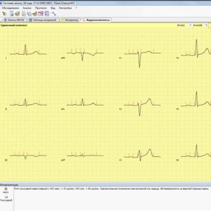 Поли-Спектр-Анализ