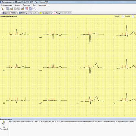Поли-Спектр-Анализ