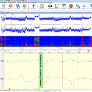 Нейрон-Спектр-CM