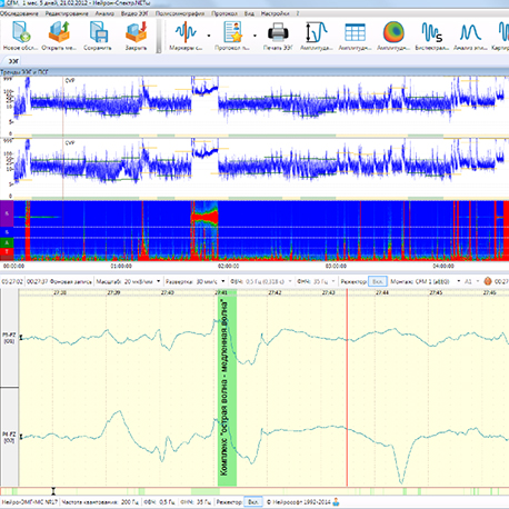 Нейрон-Спектр-CM