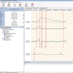 Реокардиография (РКГ) по Шрамеку